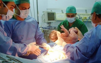 Nova Norma para Parto Cesáreo